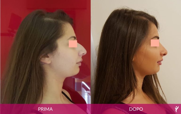 VISO-prima-dopo-03