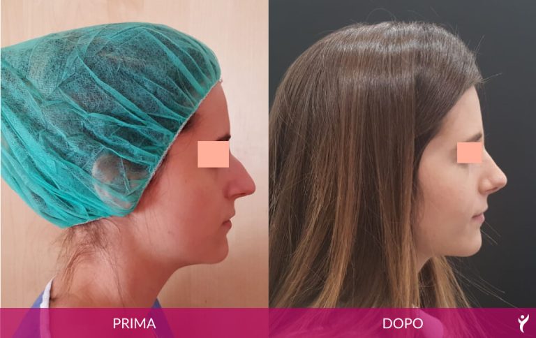 VISO-prima-dopo-05